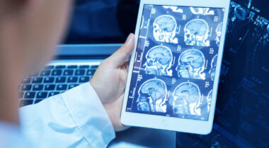 These days, a radiologist at UCSF will go through anywhere from 20 to 100 scans a day, and each scan can have thousands of images to review.